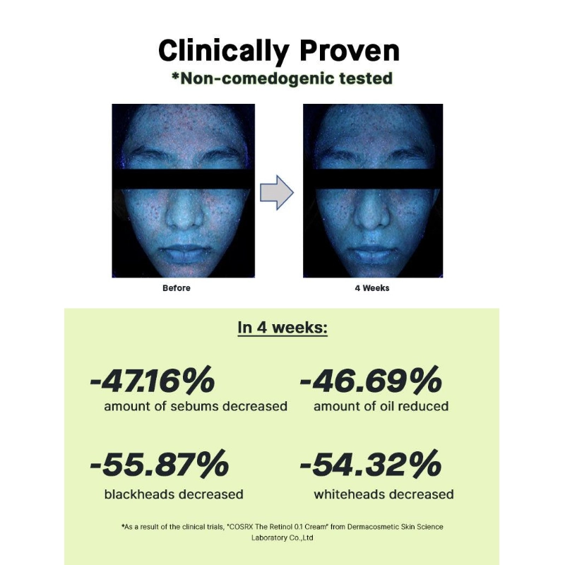 Crema anti-aging cu retinol 0.1%