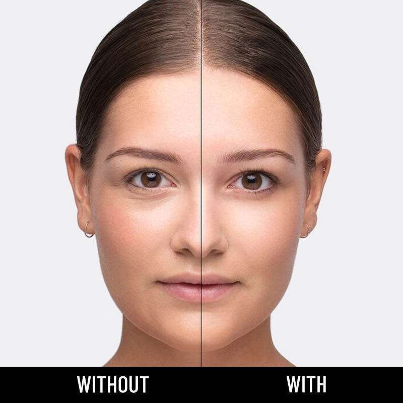 Anticearcan ultra hd self setting